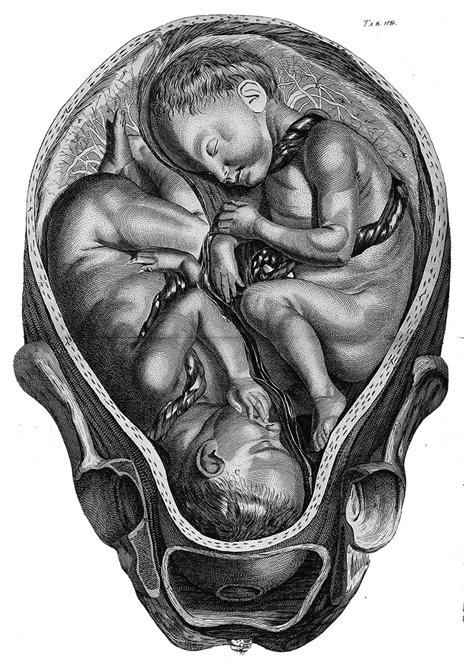 From William Hunter’s The Anatomy of the Human Gravid Uterus. Plate